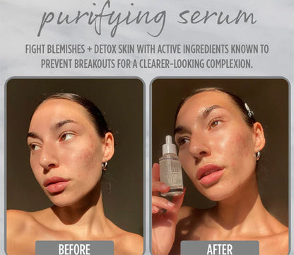 Purifying Serum
